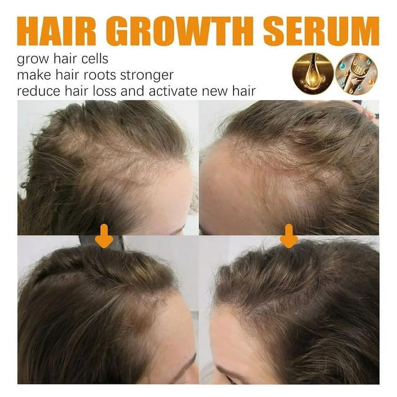 Biotin Hair Growth Spray, Ibealee Biotin Hair Growth Serum, Biotin Thickening Herbal Serum, anti Hair Loss Serum for Women Men Hair Growth and Hair Loss 5 PCS