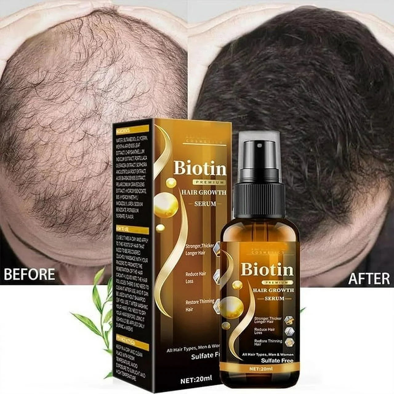 Biotin Hair Growth Spray, Ibealee Biotin Hair Growth Serum, Biotin Thickening Herbal Serum, anti Hair Loss Serum for Women Men Hair Growth and Hair Loss 5 PCS