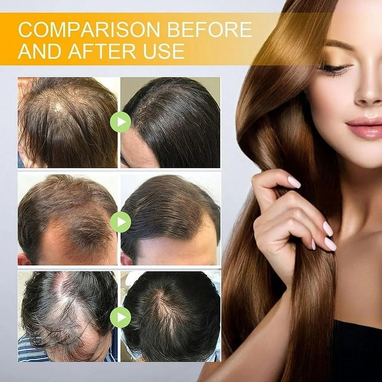 Biotin Hair Growth Spray, Ibealee Biotin Hair Growth Serum, Biotin Thickening Herbal Serum, anti Hair Loss Serum for Women Men Hair Growth and Hair Loss 5 PCS
