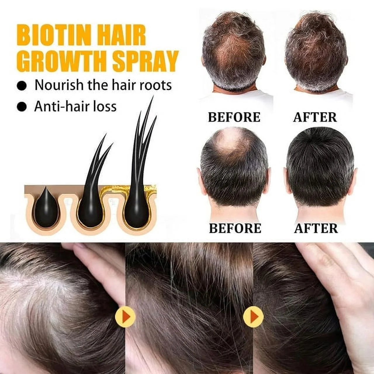 Biotin Hair Growth Spray, Ibealee Biotin Hair Growth Serum, Biotin Thickening Herbal Serum, anti Hair Loss Serum for Women Men Hair Growth and Hair Loss 5 PCS