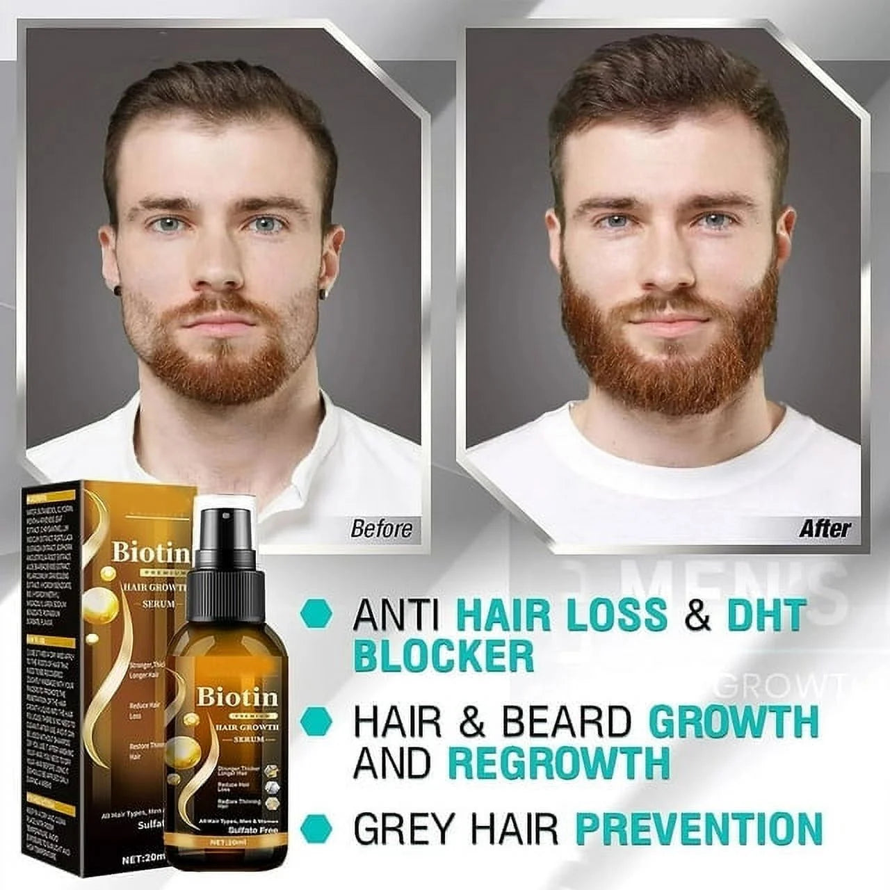 Biotin Hair Growth Spray, Ibealee Biotin Hair Growth Serum, Biotin Thickening Herbal Serum, anti Hair Loss Serum for Women Men Hair Growth and Hair Loss 5 PCS